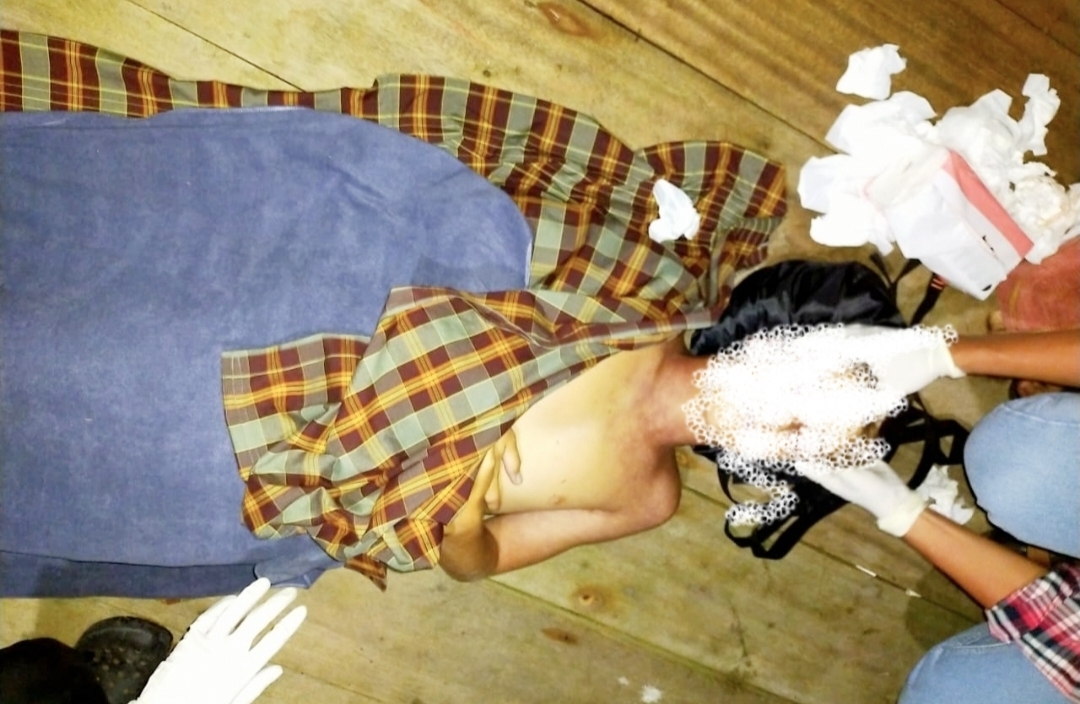 Turis Louis Marmy (19), diduga meninggal saat menyelam (Diving) tampa tabung oksigen di desa Binanguna Kecamatan Una Una Kabupaten Tojo Una Una, pada hari minggu Tanggal 12 Januari 2025 (Foto diblur)