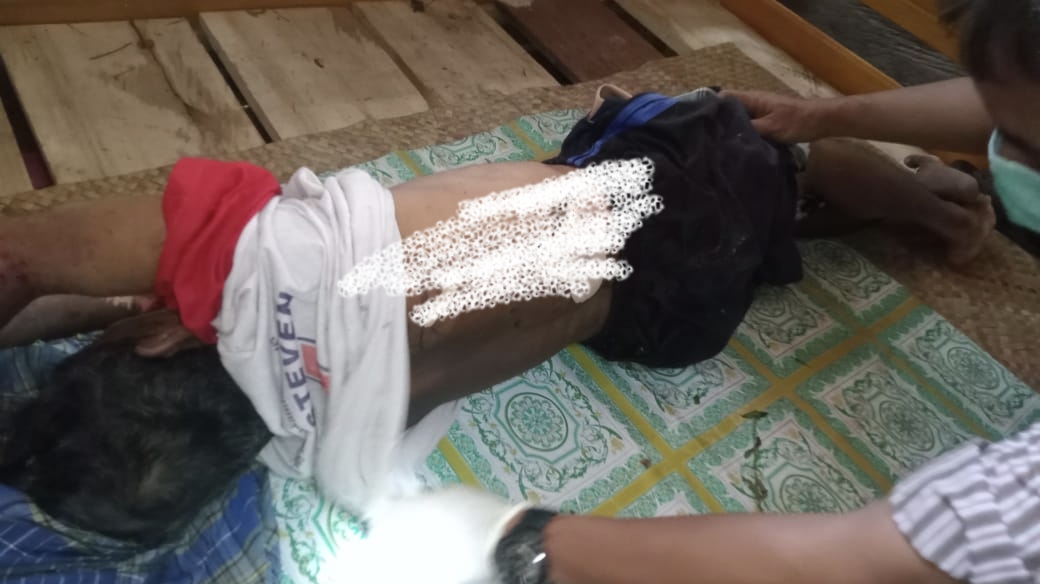 Seorang pria paruh baya warga Desa Matako Kecamatan Tojo Barat Kabupaten Tojo Una Una (Touna) di temukan takberyawa