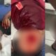 Seorang pria di Banggai menjadi korban penusukan hingga mengalami sejumlah luka serius akibat insiden tersebut